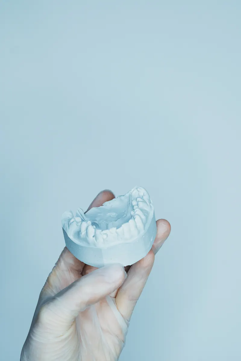 A gloved hand holds a plaster mould of a row of teeth.