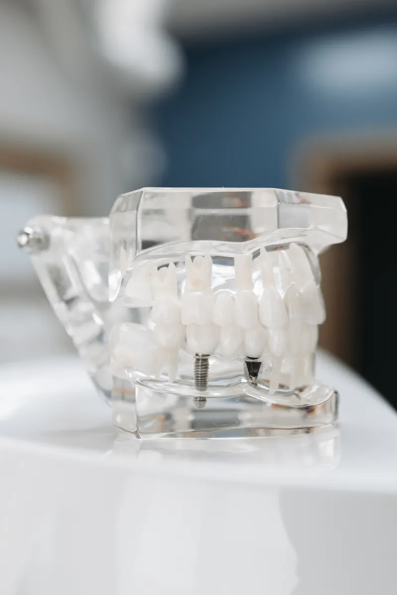 A clear plastic jaw model showing metal implant screws under two false teeth.