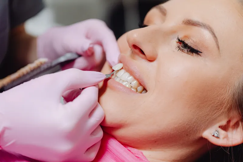 A dentist in pink gloves places a thin tooth-coloured cover on a smiling patient’s front tooth.