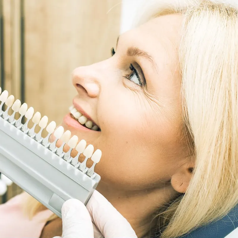A smiling patient while a shade guide of tooth colours is held up beside her teeth.