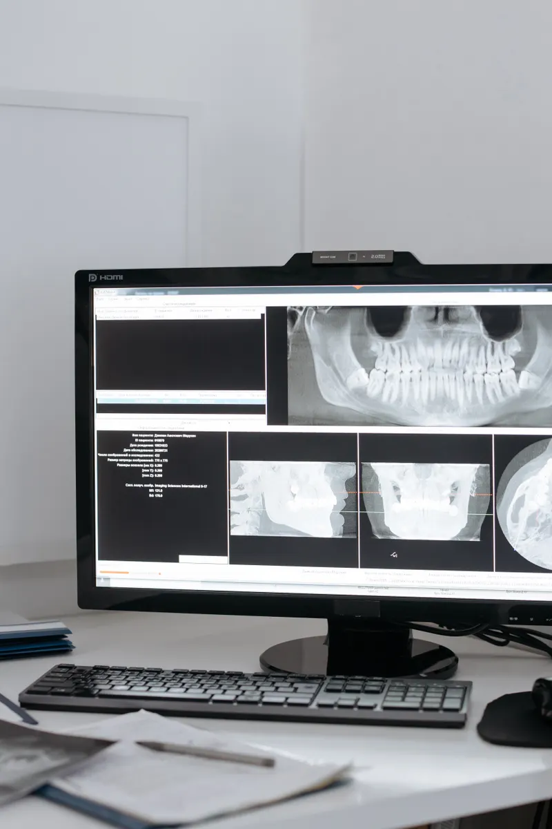 A computer screen showing digital X-ray pictures of a jaw and teeth.